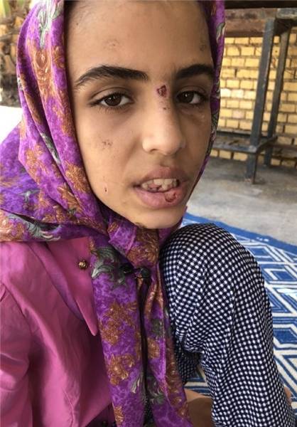 پیگیری موضوع کودک آزاری ماهشهر از پایتخت/ تکلیف حضانت بچه ها در دادگاه مشخص می شود/ تکذیب کفالت بچه ها توسط فرماندار/ لایحه مبارزه با کودک آزاری تصویب شود پیگیری موضوع کودک آزاری ماهشهر از پایتخت/ تکلیف حضانت بچه ها در دادگاه مشخص می شود/ تکذیب کفالت بچه ها توسط فرماندار/ لایحه مبارزه با کودک آزاری تصویب شود