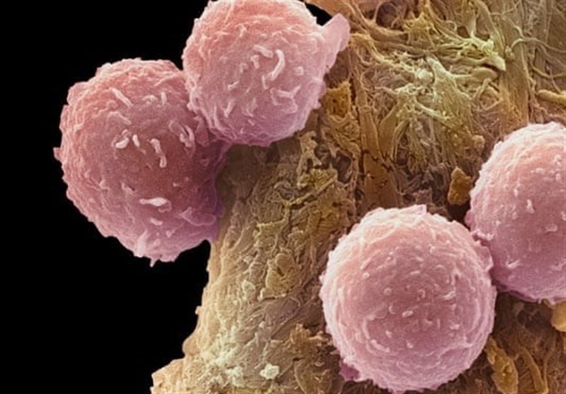 کشف کلید درمان تمام سرطانها کشف کلید درمان تمام سرطانها