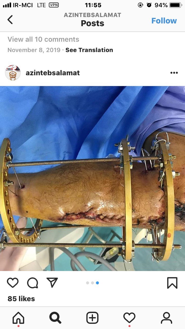 گلایه تولید کننده لوازم پزشکی اذین طب از وزارت بهداشت در تأخیر صدور مجوز