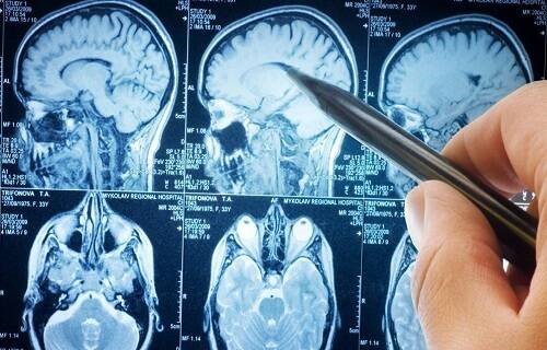 بهترین پزشکان مغز و اعصاب دنیا